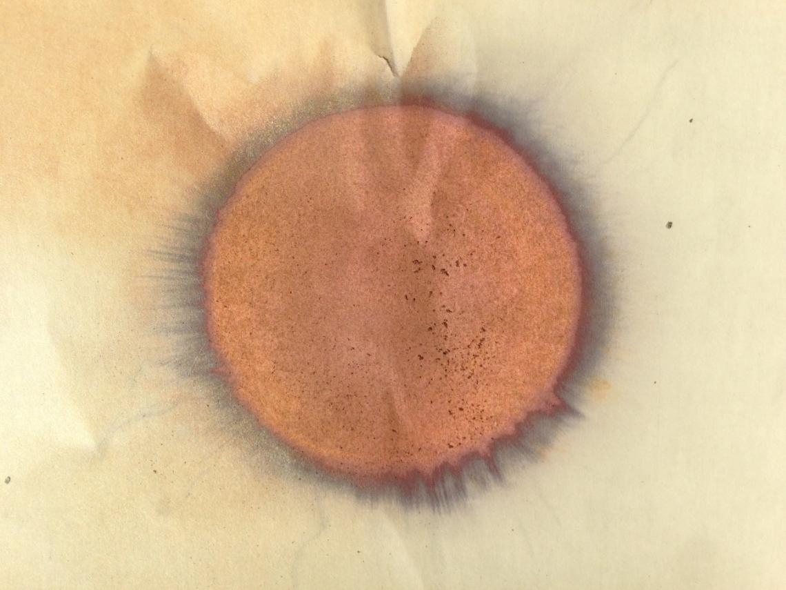 Laser burn
